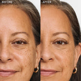 Echter Serum-Haut-Concealer