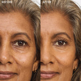 Echter Serum-Haut-Concealer